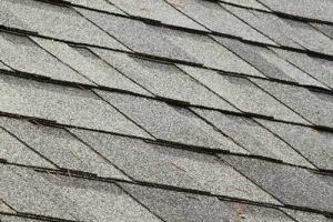 Shingles